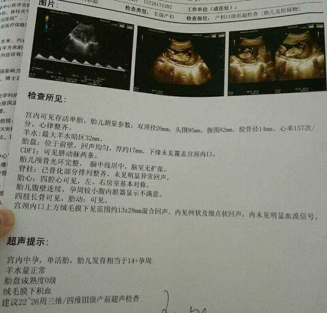 包成功太原代生, 想通过精子分离生个男孩,太原古交中心医院能做吗?